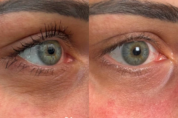 adieuconcealer adieu Augenringe